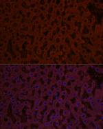 SHH Antibody in Immunocytochemistry (ICC/IF)