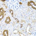 SHH Antibody in Immunohistochemistry (Paraffin) (IHC (P))