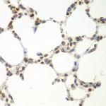 VRK1 Antibody in Immunohistochemistry (Paraffin) (IHC (P))