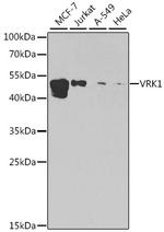 VRK1 Antibody in Western Blot (WB)