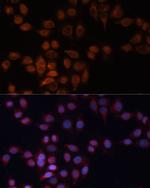 ADAM15 Antibody in Immunocytochemistry (ICC/IF)