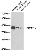 ADAM15 Antibody in Western Blot (WB)