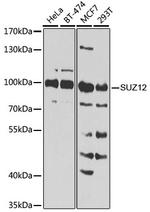 SUZ12 Antibody in Western Blot (WB)