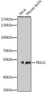 TBX22 Antibody in Western Blot (WB)