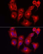 SKIP Antibody in Immunocytochemistry (ICC/IF)