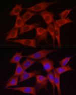 SKIP Antibody in Immunocytochemistry (ICC/IF)