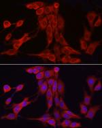 SKIP Antibody in Immunocytochemistry (ICC/IF)