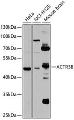 ACTR3B Antibody in Western Blot (WB)