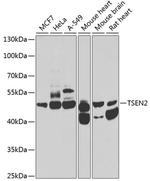 TSEN2 Antibody in Western Blot (WB)