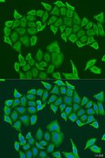 HICE1 Antibody in Immunocytochemistry (ICC/IF)