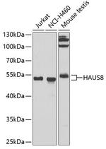 HICE1 Antibody in Western Blot (WB)