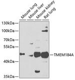 TMEM184A Antibody in Western Blot (WB)