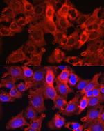 PCSK9 Antibody in Immunocytochemistry (ICC/IF)