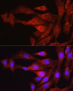 PCSK9 Antibody in Immunocytochemistry (ICC/IF)