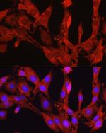 PCSK9 Antibody in Immunocytochemistry (ICC/IF)