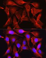 PCSK9 Antibody in Immunocytochemistry (ICC/IF)