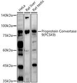 PCSK9 Antibody in Western Blot (WB)