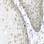 Angiopoietin 1 Antibody in Immunohistochemistry (Paraffin) (IHC (P))