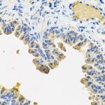 Angiopoietin 1 Antibody in Immunohistochemistry (Paraffin) (IHC (P))