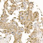 ATP1A1 Antibody in Immunohistochemistry (Paraffin) (IHC (P))