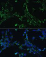 EEF1G Antibody in Immunocytochemistry (ICC/IF)