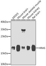 H-Ras Antibody in Western Blot (WB)