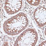 KCNS3 Antibody in Immunohistochemistry (Paraffin) (IHC (P))