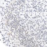 OCT3/4 Antibody in Immunohistochemistry (Paraffin) (IHC (P))