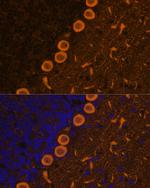 PKC gamma Antibody in Immunocytochemistry (ICC/IF)