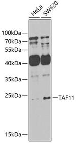 TAF11 Antibody in Western Blot (WB)