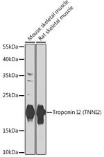 TNNI2 Antibody in Western Blot (WB)