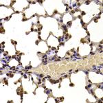 NSD2 Antibody in Immunohistochemistry (Paraffin) (IHC (P))