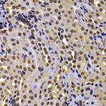 NSD2 Antibody in Immunohistochemistry (Paraffin) (IHC (P))