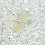 SOCS5 Antibody in Immunohistochemistry (Paraffin) (IHC (P))