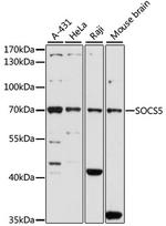 SOCS5 Antibody in Western Blot (WB)