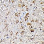 MTHFD1L Antibody in Immunohistochemistry (Paraffin) (IHC (P))