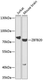 ZBTB20 Antibody in Western Blot (WB)