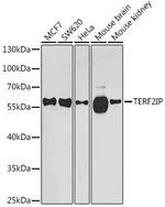 RAP1 Antibody in Western Blot (WB)