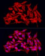 JMJD4 Antibody in Immunocytochemistry (ICC/IF)