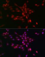 PHD3 Antibody in Immunocytochemistry (ICC/IF)