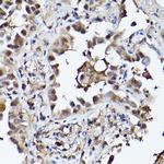 PHD3 Antibody in Immunohistochemistry (Paraffin) (IHC (P))