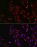 MR1 Antibody in Immunocytochemistry (ICC/IF)