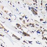 MBNL1 Antibody in Immunohistochemistry (Paraffin) (IHC (P))