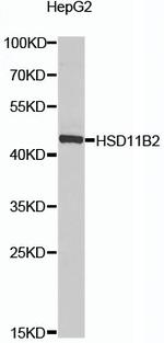 HSD11B2 Antibody in Western Blot (WB)