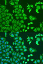 CAPZB Antibody in Immunocytochemistry (ICC/IF)