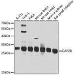 CAPZB Antibody in Western Blot (WB)
