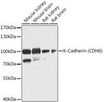 K-cadherin Antibody in Western Blot (WB)