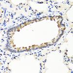 IFN omega Antibody in Immunohistochemistry (Paraffin) (IHC (P))