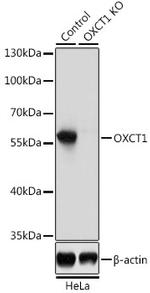 OXCT1 Antibody