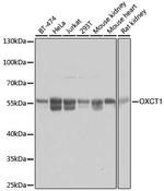 OXCT1 Antibody in Western Blot (WB)